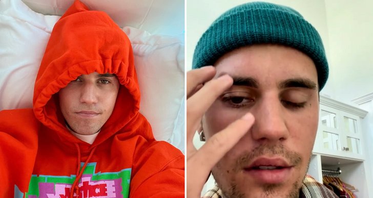 Justin Bieber avbryter turné – ställer in konsert i Sverige